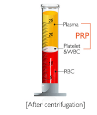 Platelet-Rich-Plasma-therapy-for-Dogs